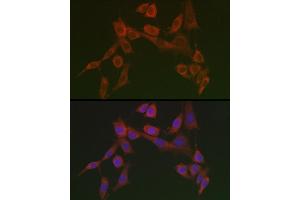 Immunofluorescence analysis of NIH/3T3 cells using HSP47/SERPINH1 Rabbit pAb  at dilution of 1:100 (40x lens). (SERPINH1 抗体)