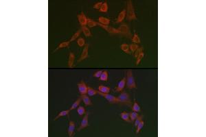 Immunofluorescence (IF) image for anti-Serpin Family H Member 1 (SERPINH1) antibody (ABIN6147614)