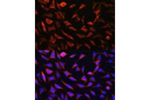 Immunofluorescence (IF) image for anti-Solute Carrier Family 25 (Mitochondrial Carrier: Glutamate), Member 22 (SLC25A22) (AA 128-188) antibody (ABIN7270436)