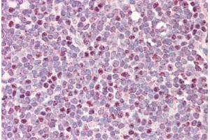 Human Tonsil: Formalin-Fixed, Paraffin-Embedded (FFPE) (CDCA5 抗体  (AA 110-159))