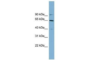 Cytokeratin 84 antibody used at 1 ug/ml to detect target protein. (Keratin 84 抗体  (Middle Region))