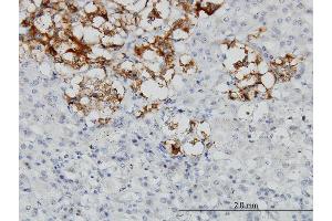 Immunoperoxidase of monoclonal antibody to DCN on formalin-fixed paraffin-embedded human adrenal gland. (Decorin 抗体  (AA 1-359))