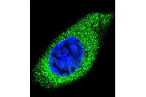 Immunofluorescence (IF) image for anti-Collagen, Type XXI, alpha 1 (COL21A1) (AA 204-232), (N-Term) antibody (ABIN656084)