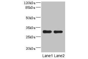 Western blot All lanes: DRAM2 antibody at 3. (DRAM2 抗体  (AA 182-266))