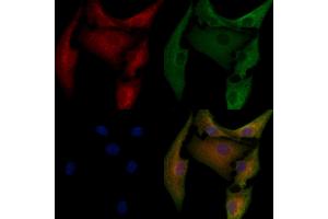 ABIN6260030 and ABIN6276614 staining  cells by IF/ICC.