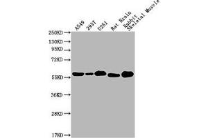 Western Blot Positive WB detected in: A549 whole cell lysate, 293T whole cell lysate, U251 whole cell lysate, Rat Brain tissue, Rabbit Skeletal Muscle tissue All lanes: PKM antibody at 1:1000 Secondary Goat polyclonal to Mouse IgG at 1/10000 dilution Predicted band size: 58 kDa Observed band size: 58 KDa Exposure time: 1 min (PKM 抗体  (AA 2-531))