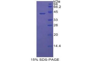 SDS-PAGE analysis of Rat Lipocalin 6 Protein. (LCN6 蛋白)