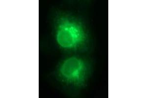 Immunofluorescence (IF) image for anti-T-cell surface glycoprotein CD1c (CD1C) antibody (ABIN2670676) (CD1c 抗体)