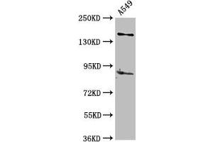 Western Blot Positive WB detected in: A549 whole cell lysate All lanes: AFF2 antibody at 5 μg/mL Secondary Goat polyclonal to rabbit IgG at 1/50000 dilution Predicted band size: 145, 141, 48, 144, 106 kDa Observed band size: 145 kDa (AFF2 抗体  (AA 575-705))