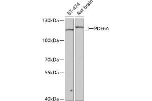 Western blot analysis of extracts of various cell lines, using PDE6A antibody (ABIN6130650, ABIN6145361, ABIN6145362 and ABIN6223910) at 1:1000 dilution. (PDE6A 抗体  (AA 656-860))