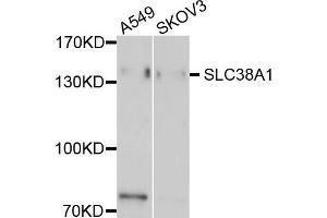 Western blot analysis of extract of A549 and SKOV3 cells, using EMILIN1 antibody. (Emilin1 抗体)
