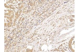 Immunohistochemistry (IHC) image for anti-Tubulin, beta (TUBB) (AA 170-419) antibody (ABIN7443818)
