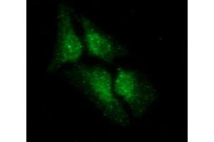 ICC/IF analysis of LSM5 in HeLa cells line, stained with DAPI (Blue) for nucleus staining and monoclonal anti-human LSM5 antibody (1:100) with goat anti-mouse IgG-Alexa fluor 488 conjugate (Green).