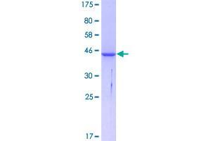 ACP1 Protein (AA 1-158) (GST tag)