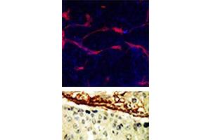 TOP: Methanol/Acetone fixed human stem cell is used in IF to detect Eph4A (blue) and endothelial Lectin(red). (EPH Receptor A4 抗体  (N-Term))