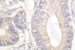 Image no. 1 for anti-Gastrin (GAST) antibody (ABIN265432) (Gastrin 抗体)