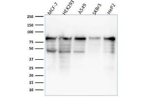Western Blot Analysis of MCF-7, HEK-293, A549, SKBr3, HeP2 lysate using MCM7 Mouse Monoclonal Antibody (MCM7/1468). (MCM7 抗体  (AA 195-319))