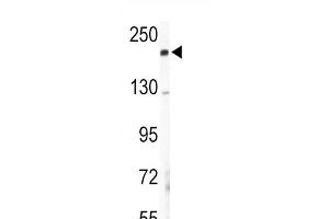 Western blot analysis of COL5A2 Antibody (N-term) (ABIN391537 and ABIN2841488) in mouse lung tissue lysates (35 μg/lane). (COL5A2 抗体  (N-Term))