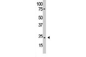 The PDGFA polyclonal antibody  is used in Western blot to detect PDGFA in HL-60 cell lysate. (PDGFA 抗体  (N-Term))