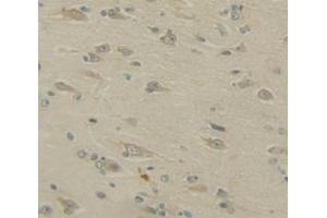 Immunohistochemistry (IHC) image for anti-Amyloid beta (A4) Precursor Protein-Binding, Family A, Member 2 (APBA2) (AA 459-722) antibody (ABIN5013121)