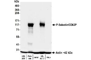Western Blotting (WB) image for anti-Selectin P (Granule Membrane Protein 140kDa, Antigen CD62) (SELP) (AA 42-771) antibody (ABIN7795665)
