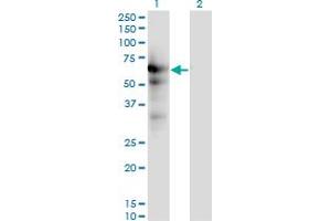 Western Blotting (WB) image for anti-Ubiquitin Specific Peptidase 14 (USP14) (AA 395-494) antibody (ABIN563939)