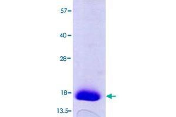 TXNDC17 Protein (AA 1-123) (His tag)