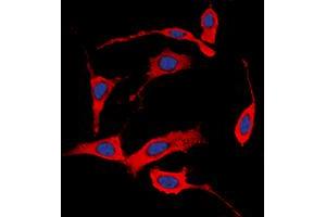 Immunofluorescent analysis of HER4 (pY1284) staining in MCF7 cells. (ERBB4 抗体  (C-Term, pTyr1284))