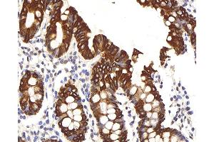 Immunohistochemistry analysis of paraffin-embedded human colon using CK-8 Polyclonal Antibody at dilution of 1:200. (KRT8 抗体)