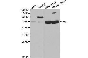 Western blot analysis of extracts of various cell lines, using PAH antibody. (Phenylalanine Hydroxylase 抗体  (AA 1-290))
