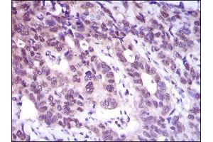 Immunohistochemistry (IHC) image for anti-ATP Citrate Lyase (ACLY) (AA 306-502) antibody (ABIN1842880) (ACLY 抗体  (AA 306-502))