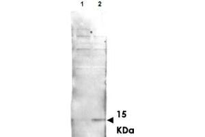 Western blot using His2Av (phospho S137) polyclonal antibody  shows detection of aband at ~ 15 KDa corresponding to Phospho-His2Av S137 (Lane 2 arrow-head). (H2AFV 抗体  (pSer137))