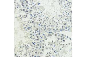 Immunohistochemistry (IHC) image for anti-Bromodomain Adjacent To Zinc Finger Domain, 2A (BAZ2A) antibody (ABIN7265937)