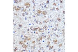 Immunohistochemistry of paraffin-embedded mouse brain using EL Rabbit pAb (ABIN7266914) at dilution of 100 (40x lens).
