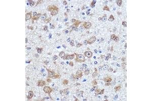 Immunohistochemistry of paraffin-embedded mouse brain using EL Rabbit pAb (ABIN7266914) at dilution of 100 (40x lens). (ELAVL4 抗体  (AA 1-366))