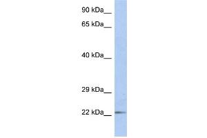 WB Suggested Anti-DUT Antibody Titration:  1 ug/ml  Positive Control:  Fetal Small Intestine cell lysate