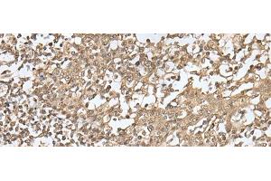 Immunohistochemistry of paraffin-embedded Human tonsil tissue using ZKSCAN1 Polyclonal Antibody at dilution of 1:30(x200) (ZKSCAN1 抗体)