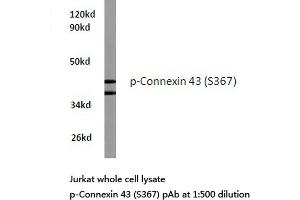 Western blot (WB) analyzes of p-Connexin 43 antibody in extracts from Jurkat cells. (Connexin 43/GJA1 抗体  (pSer367))