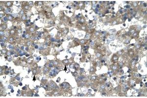 Immunohistochemical staining (Formalin-fixed paraffin-embedded sections) of human liver with KLF15 polyclonal antibody . (KLF15 抗体  (AA 45-94))