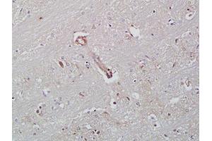 Formalin-fixed and paraffin embedded rat brain labeled with Rabbit Anti-ICAM-2/CD102 Polyclonal Antibody, Unconjugated  at 1:200 followed by conjugation to the secondary antibody and DAB staining (ICAM2 抗体  (AA 175-277))
