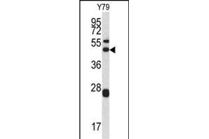 Western blot analysis of ARPC1A antibody (Center) (ABIN390418 and ABIN2840806) in Y79 cell line lysates (35 μg/lane). (ARPC1A 抗体  (AA 157-184))
