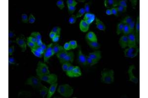 Immunofluorescence staining of MCF-7 cells with ABIN7160429 at 1:66, counter-stained with DAPI.