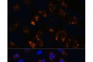 Immunofluorescence analysis of U2OS cells using TGFB1 Polyclonal Antibody at dilution of 1:100. (TGFB1 抗体)