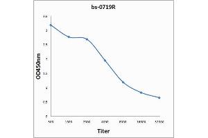 Antigen: 0. (CEA 抗体  (AA 315-365))