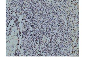 IHC analysis of LSM8 using anti-LSM8 antibody (ABIN7599578). (NAA38 抗体  (AA 1-96))