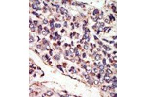 Image no. 1 for anti-Neurotrophic tyrosine Kinase, Receptor, Type 3 (NTRK3) (N-Term) antibody (ABIN359954)