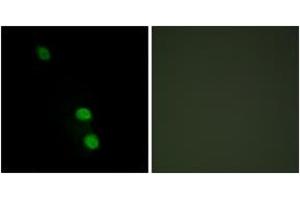 Immunofluorescence analysis of HepG2 cells, using TEAD2 Antibody. (TEAD2 抗体  (AA 71-120))