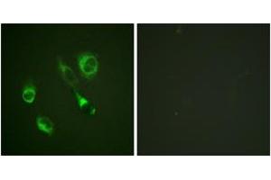 Immunofluorescence analysis of HeLa cells, using EPHA2/3 (Phospho-Tyr588/596) Antibody. (EPHA2/3 抗体  (pTyr588))