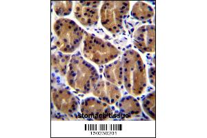 PKP2 Antibody immunohistochemistry analysis in formalin fixed and paraffin embedded human stomach tissue followed by peroxidase conjugation of the secondary antibody and DAB staining. (Plakophilin 2 抗体  (C-Term))