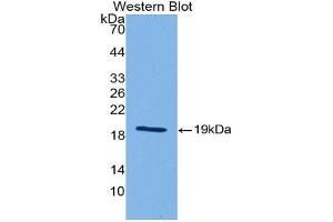 Western blot analysis of the recombinant protein. (Sonic Hedgehog 抗体  (AA 28-192))